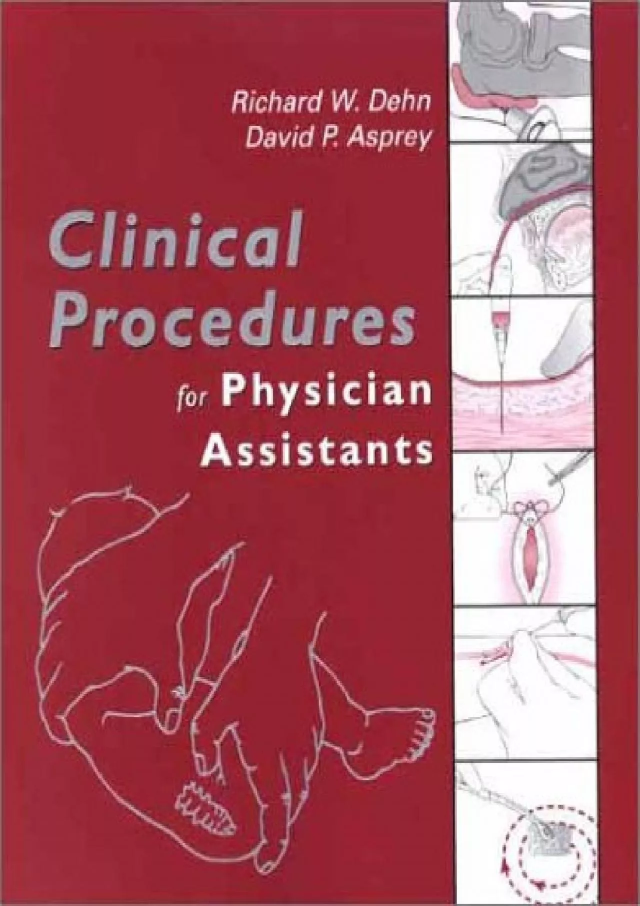 (BOOK)-Clinical Procedures for Physician Assistants: Expert Consult - Online and Print