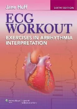 (BOOS)-ECG Workout: Exercises in Arrhythmia Interpretation (Huff, ECG Workout)