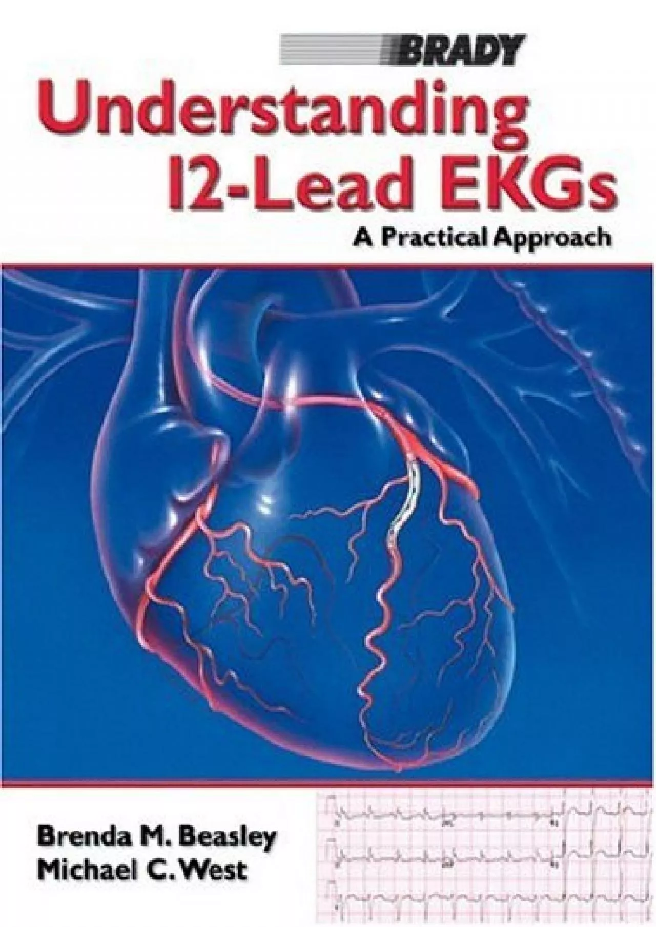 (EBOOK)-Understanding 12-Lead EKGs: A Practical Approach