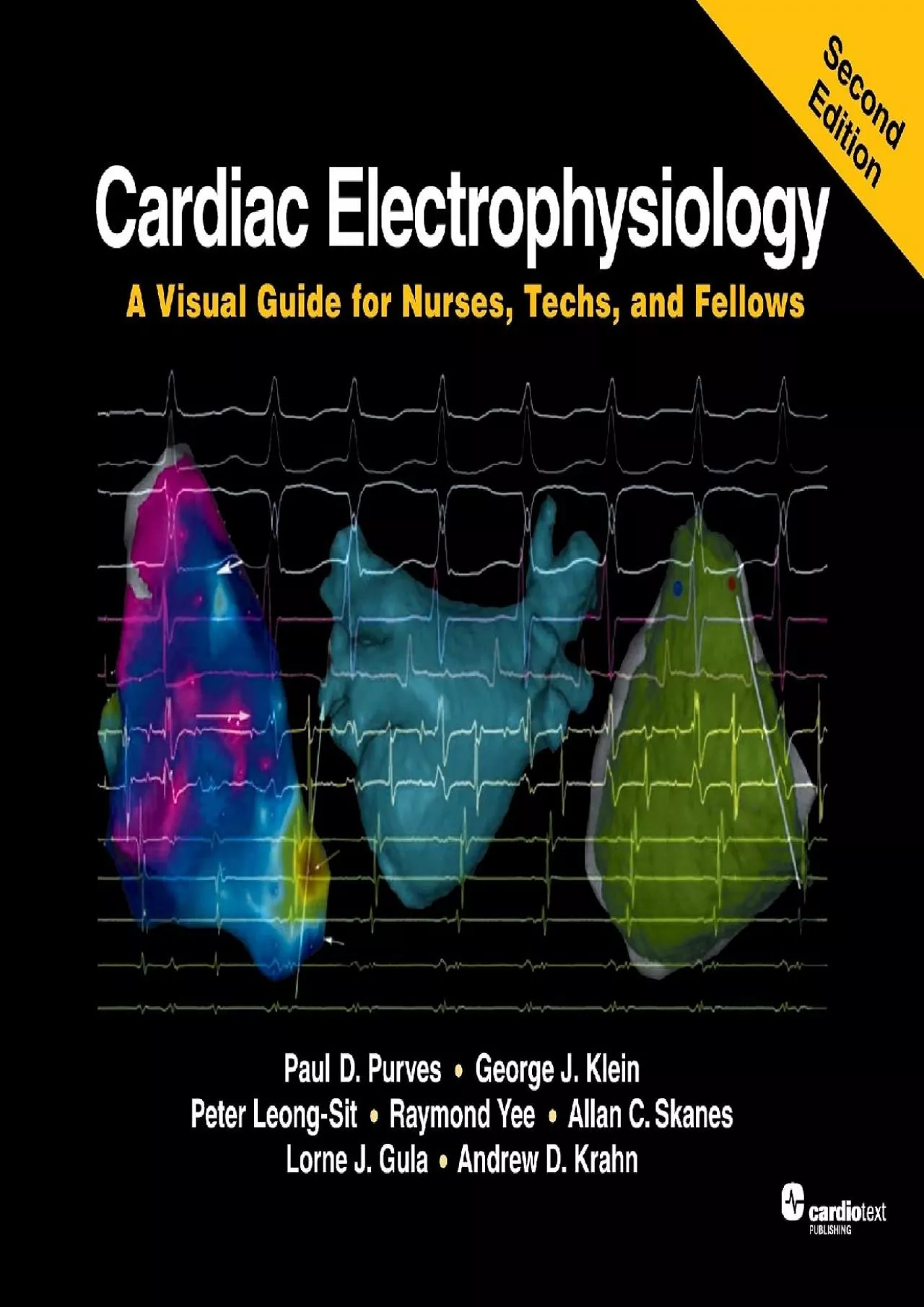 PDF-(EBOOK)-Cardiac Electrophysiology: A Visual Guide for Nurses, Techs, and Fellows, 2nd