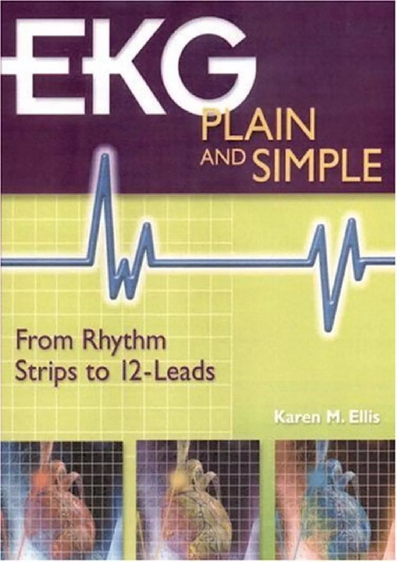 PDF-(DOWNLOAD)-EKG Plain and Simple: From Rhythm Strips to 12-Leads