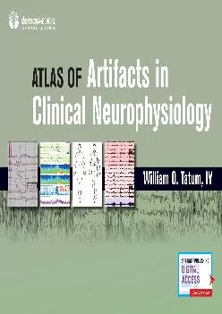 (EBOOK)-Atlas of Artifacts in Clinical Neurophysiology