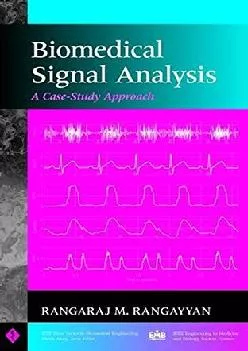 (DOWNLOAD)-Biomedical Signal Analysis: A Case-Study Approach