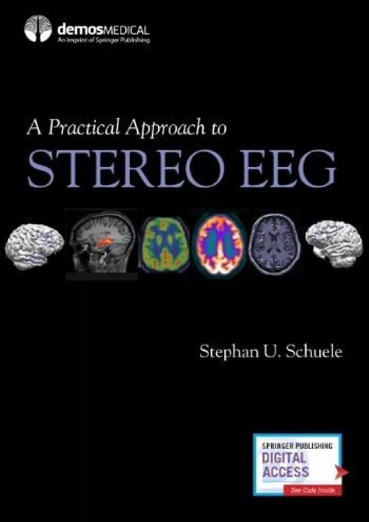 PDF-(BOOS)-A Practical Approach to Stereo EEG