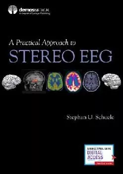 (BOOS)-A Practical Approach to Stereo EEG