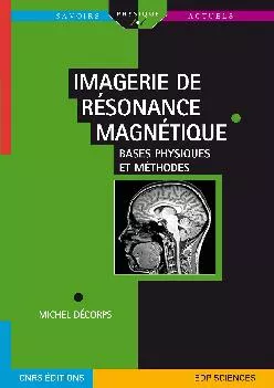 (READ)-Imagerie de résonance magnétique (French Edition)