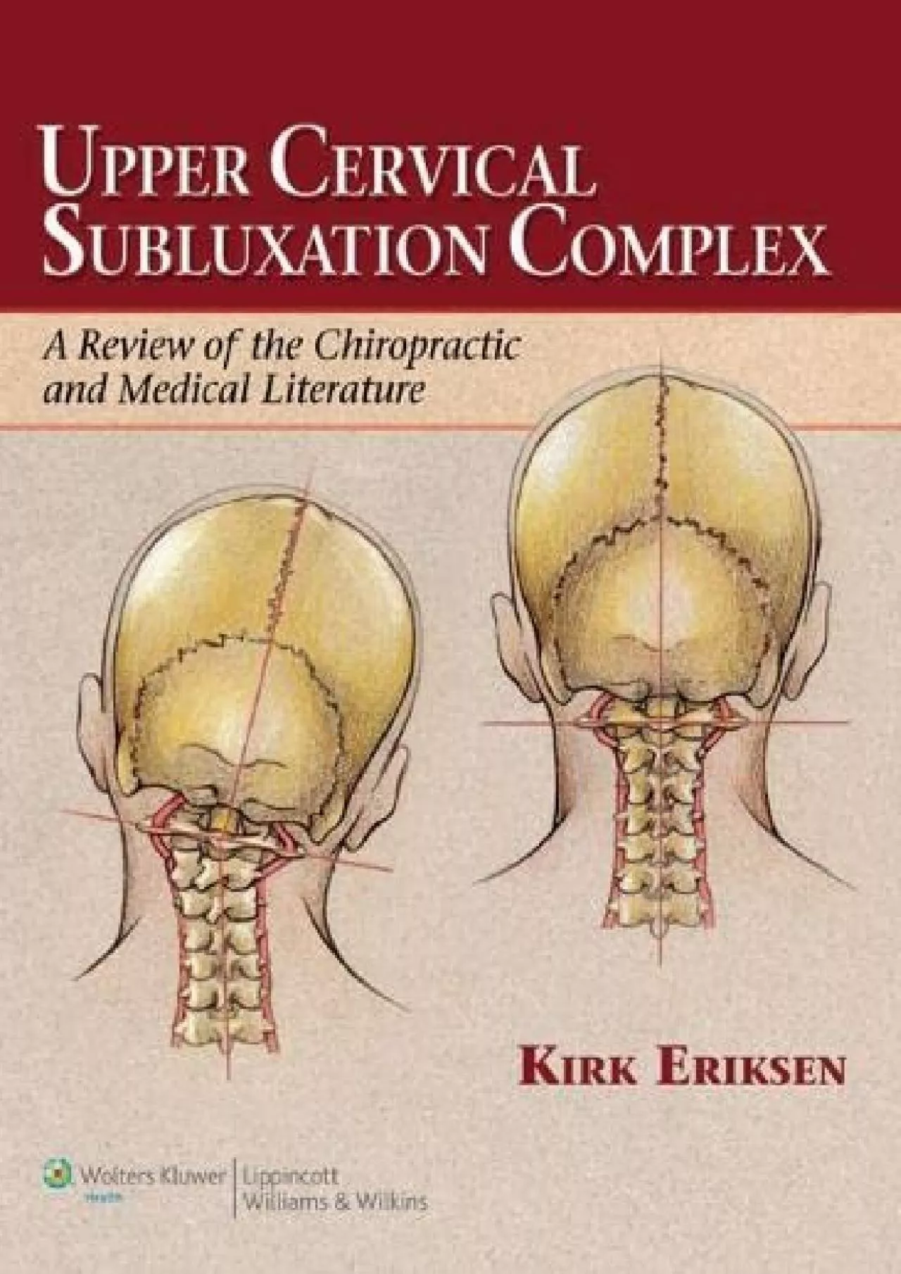 (DOWNLOAD)-Upper Cervical Subluxation Complex: A Review of the Chiropractic and Medical