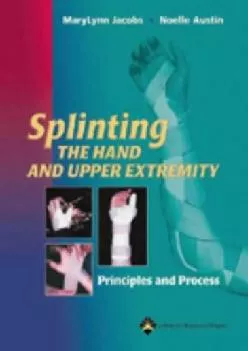 (READ)-Splinting the Hand and Upper Extremity: Principles and Process