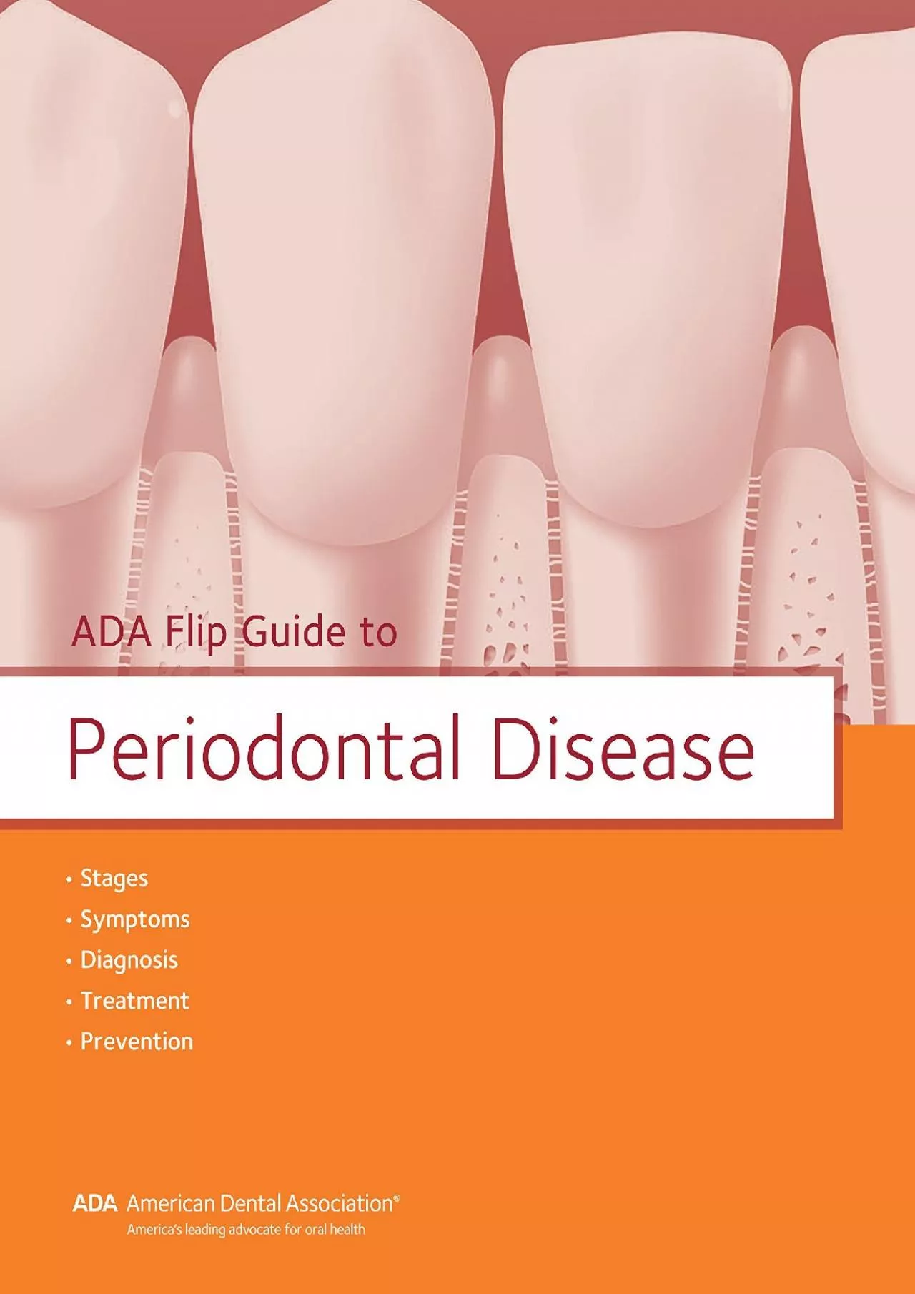 (READ)-ADA Flip Guide to Periodontal Disease (ADA Flip Guides)