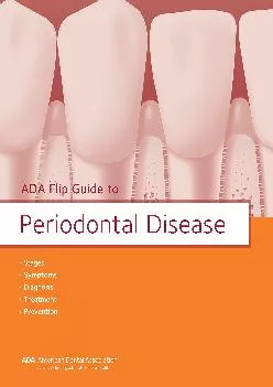 (READ)-ADA Flip Guide to Periodontal Disease (ADA Flip Guides)