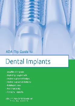 (BOOK)-ADA Flip Guide to Dental Implants (ADA Flip Guides)