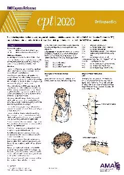 (BOOS)-CPT 2020 Express Reference Coding Card: Orthopaedics