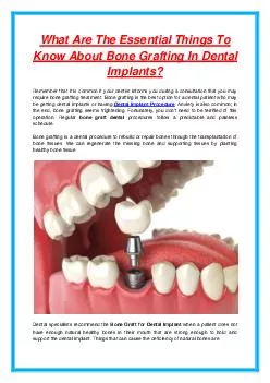 What Are The Essential Things To Know About Bone Grafting In Dental Implants?