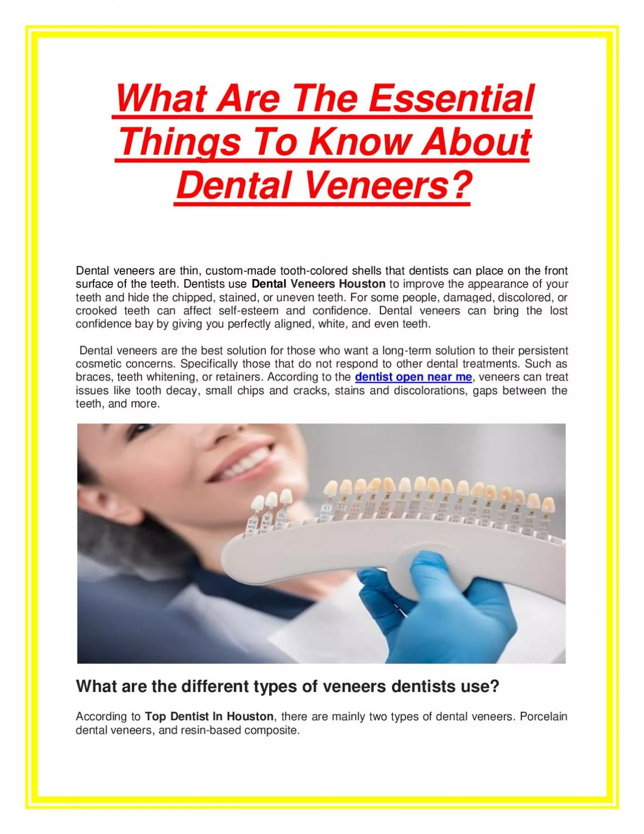 PDF-What Are The Essential Things To Know About Dental Veneers?