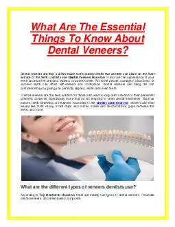 What Are The Essential Things To Know About Dental Veneers?