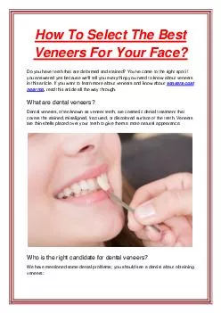 How To Select The Best Veneers For Your Face?