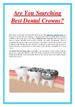 Are You Searching Best Dental Crowns?