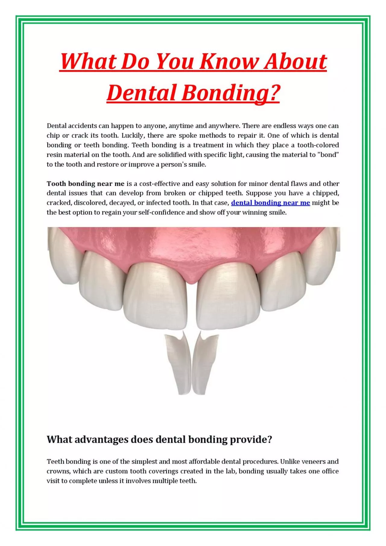 PDF-What Do You Know About Dental Bonding?