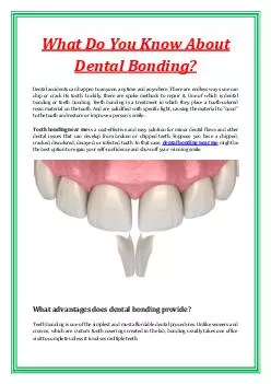 What Do You Know About Dental Bonding?