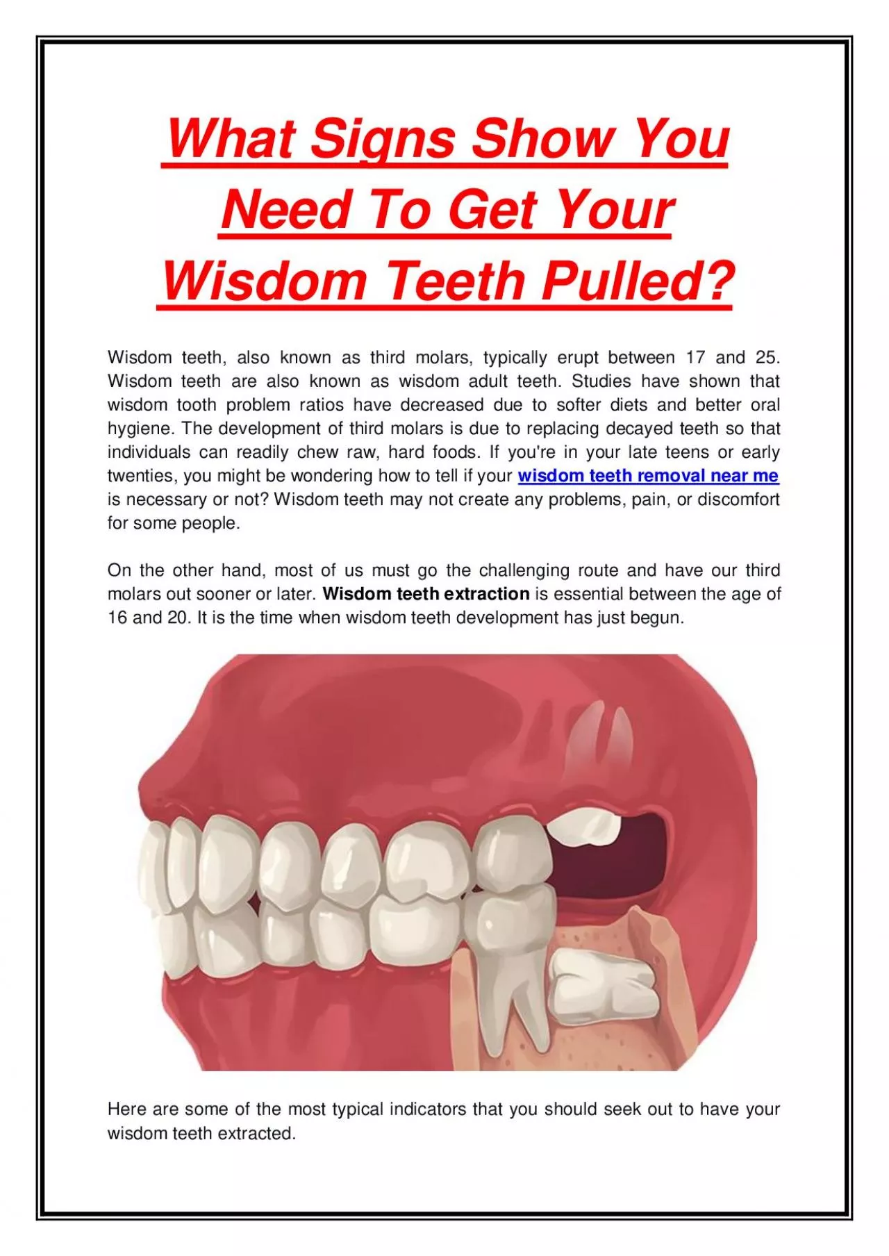 PDF-What Signs Show You Need To Get Your Wisdom Teeth Pulled?