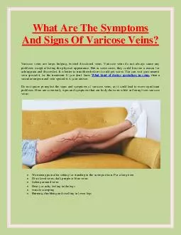 What Are The Symptoms And Signs Of Varicose Veins?