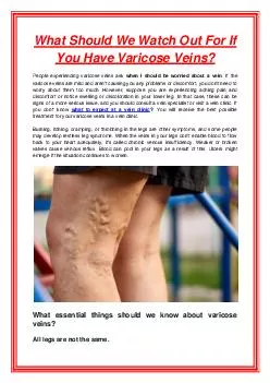 What Should We Watch Out For If You Have Varicose Veins?