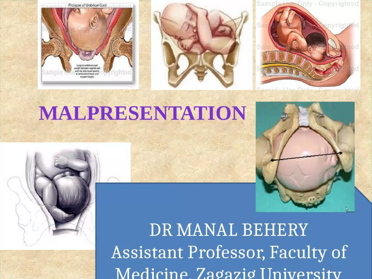 PPT-MALPRESENTATION DR MANAL BEHERY