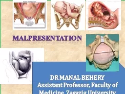 MALPRESENTATION DR MANAL BEHERY