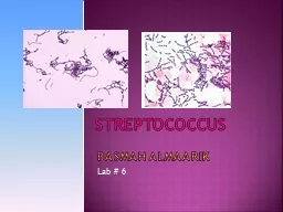 Streptococcus Basmah  almaarik