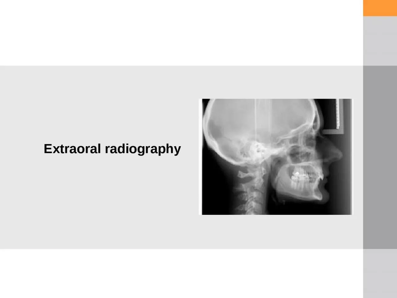 PPT-Extraoral radiography MAIN MAXILLOFACIAL PROJECTION