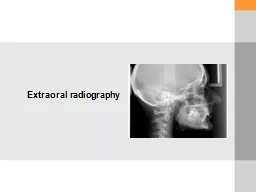 Extraoral radiography MAIN MAXILLOFACIAL PROJECTION