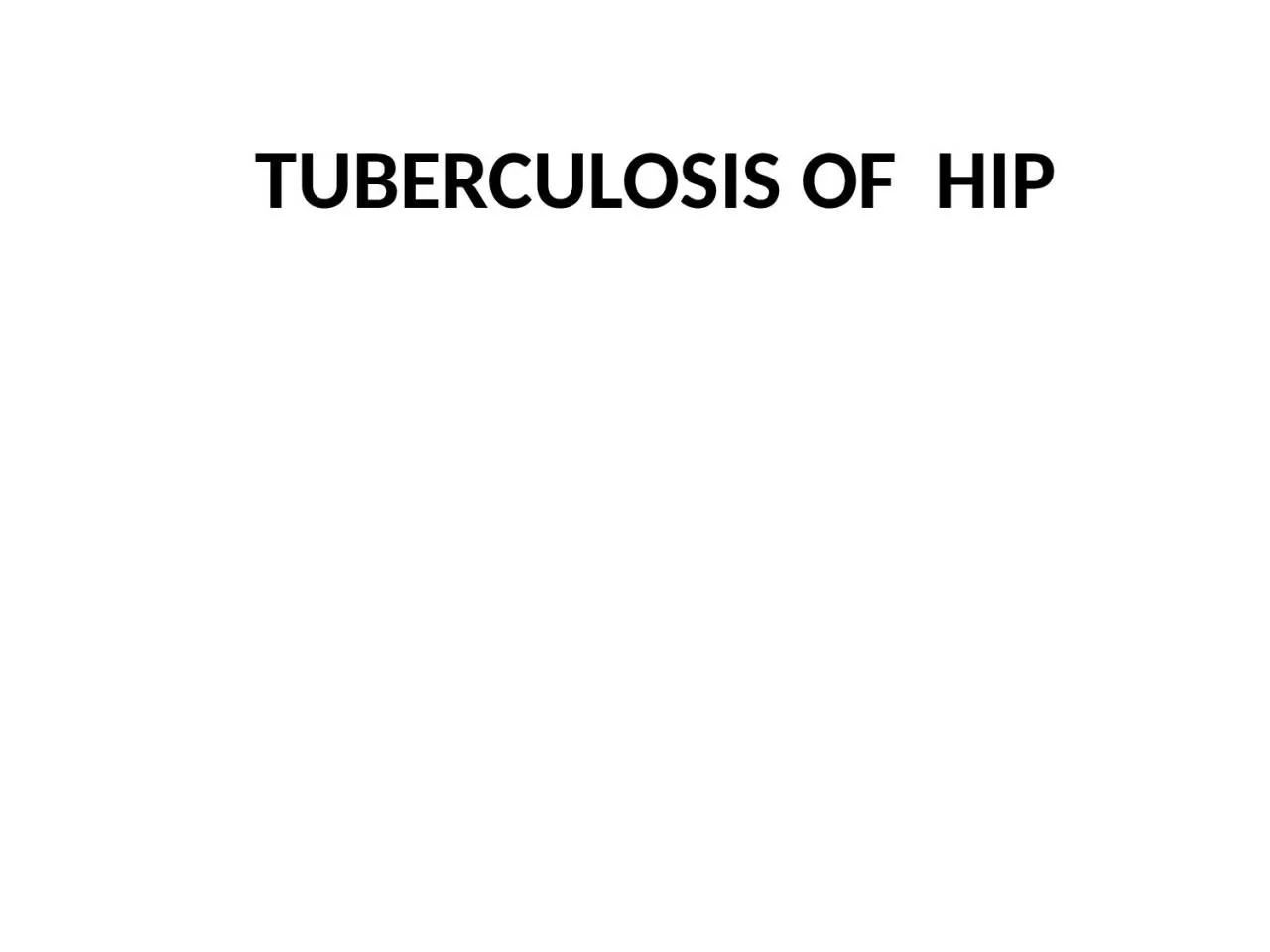 PPT-TUBERCULOSIS OF HIP TB Knee Joint