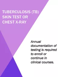 Tuberculosis (TB) skin test or chest x-ray