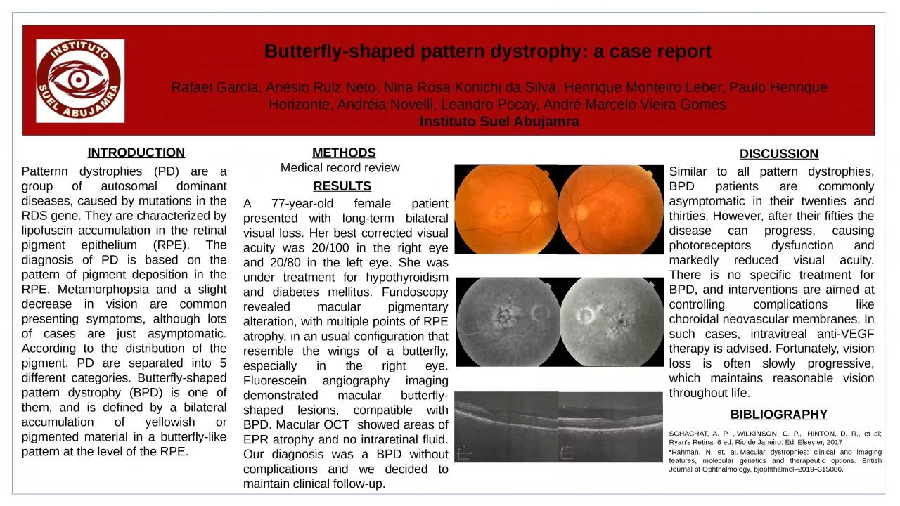 Butterfly-shaped pattern dystrophy: a case report