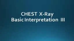 CHEST   X-Ray                           Basic