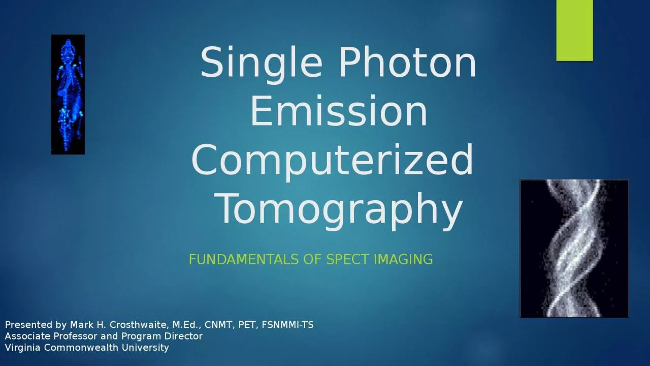 Single Photon Emission Computerized