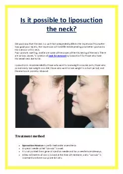 Is it possible to liposuction the neck?