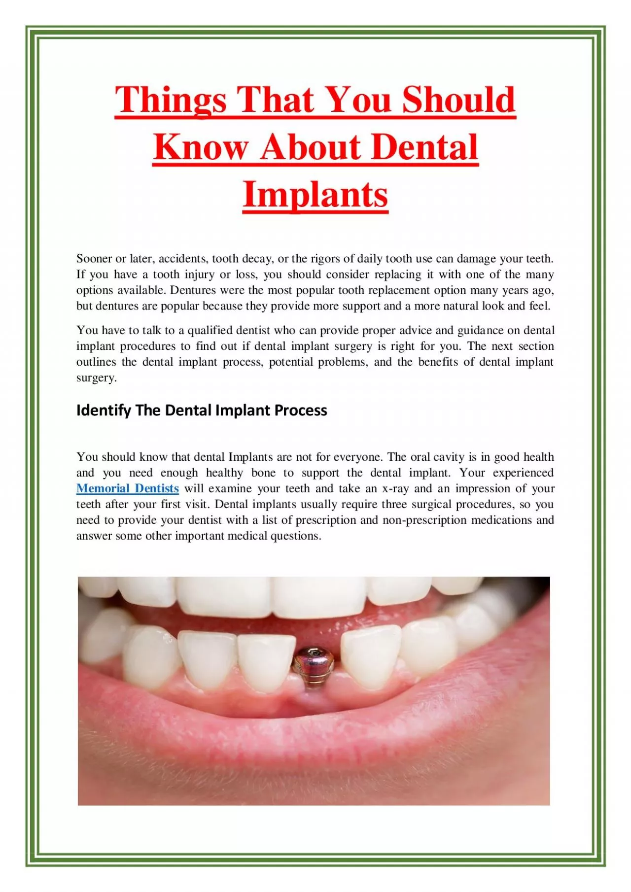 Things That You Should Know About Dental Implants