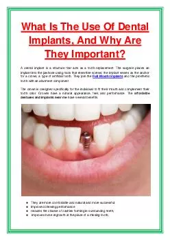 What Is The Use Of Dental Implants, And Why Are They Important?