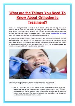 What are the Things You Need To Know About Orthodontic Treatment?