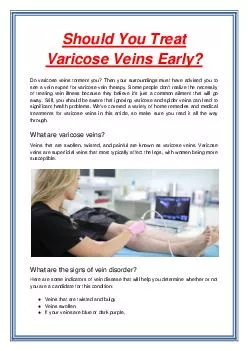 Should You Treat Varicose Veins Early?