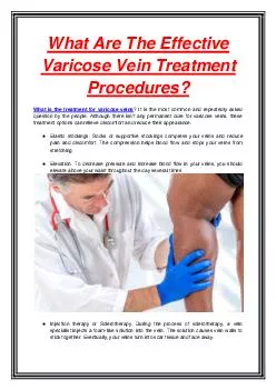 What Are The Effective Varicose Vein Treatment Procedures?