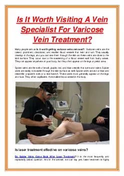 Is It Worth Visiting A Vein Specialist For Varicose Vein Treatment?