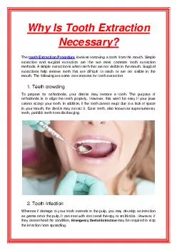 Why Is Tooth Extraction Necessary?