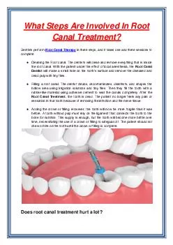 What Steps Are Involved In Root Canal Treatment?