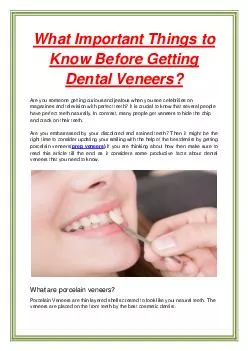 What Important Things to Know Before Getting Dental Veneers?