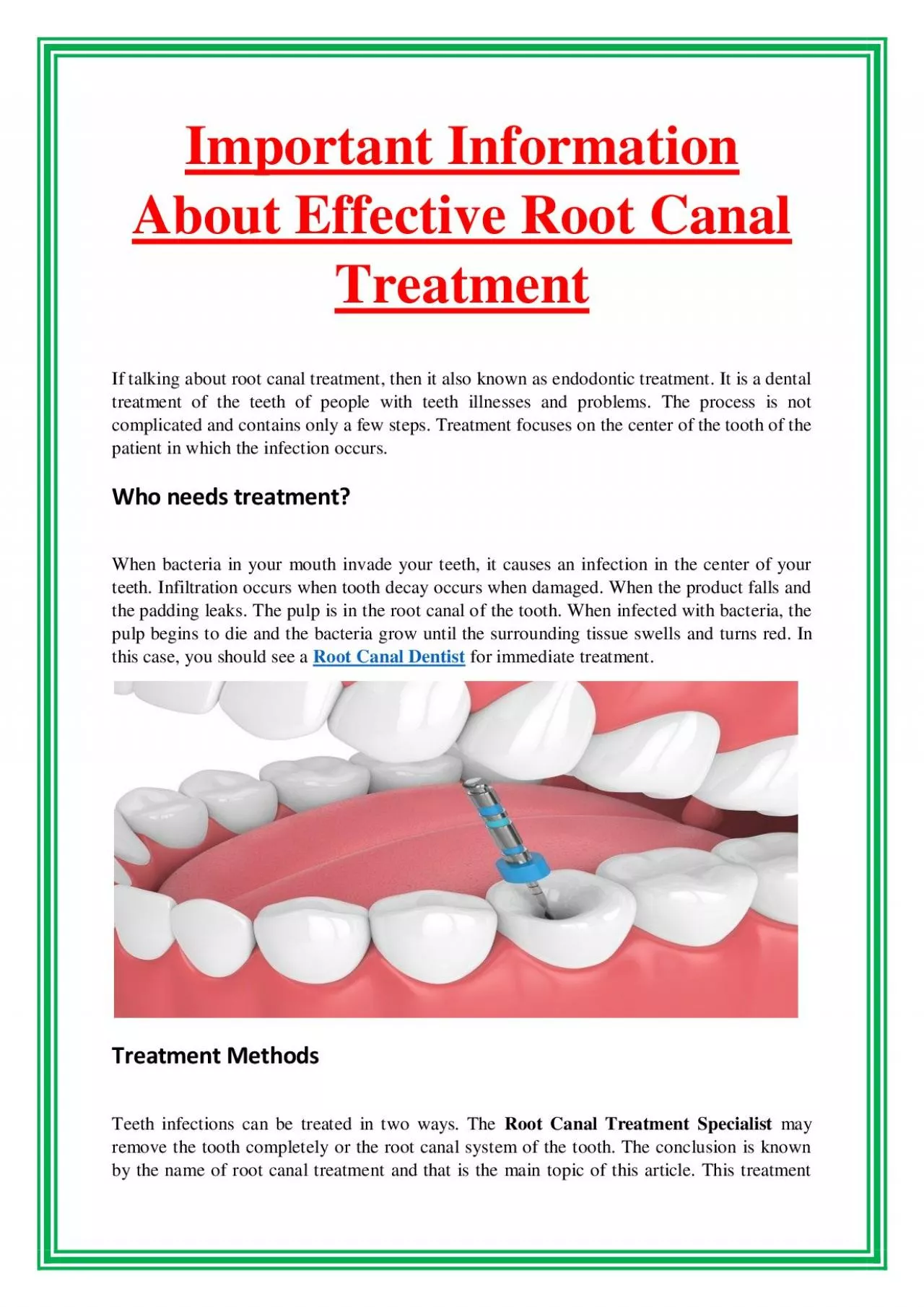 Important Information About Effective Root Canal Treatment