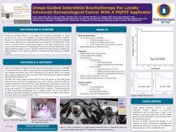 Image Guided Interstitial Brachytherapy For Locally Advanced