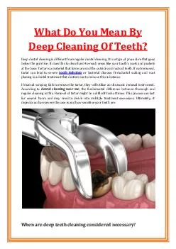 What Do You Mean By Deep Cleaning Of Teeth?