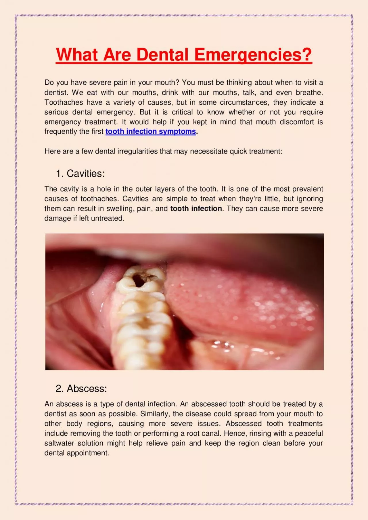 PDF-What Are Dental Emergencies?